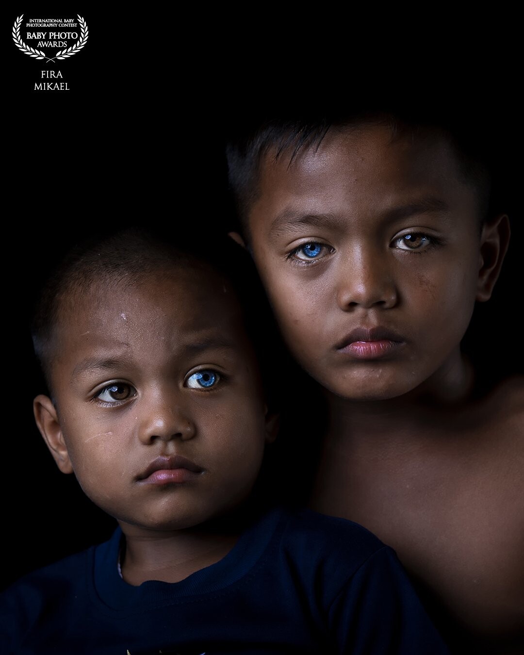 Fahri and Gofar are siblings who suffer from a genetic disorder called Waardenburg syndrome. This syndrome causes pupils to turn blue, lose hearing and lose the ability to speak for them.